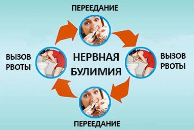 Лечение булимии в Чебоксарах